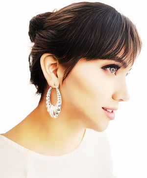 Aretes